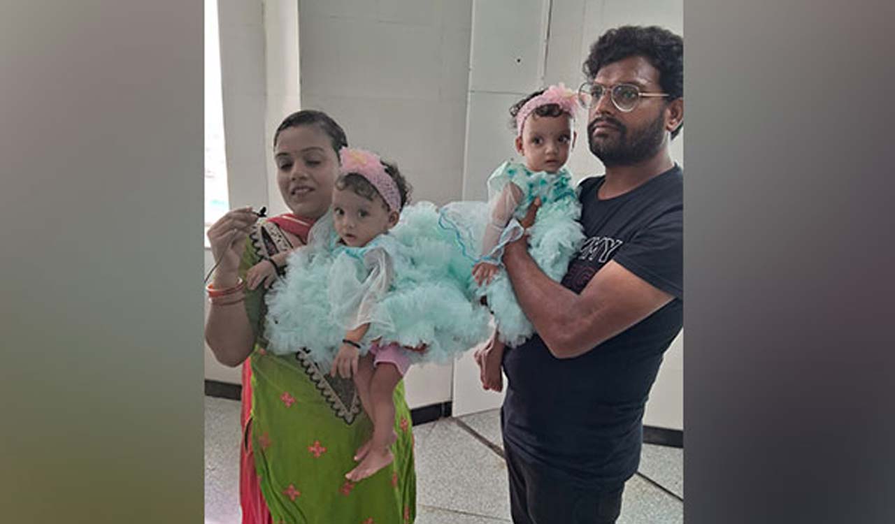 Delhi: Conjoined twins successfully separated at AIIMS in 9-hour surgery, ready to be discharged