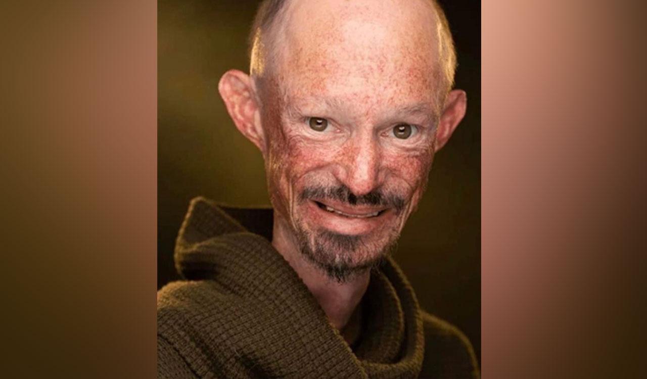 Actor Darren Kent from ‘Game of Thrones’ passes away