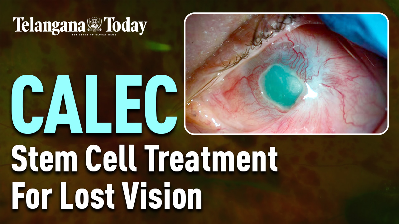 Vision Can Now Be Restored With CALEC | Cultivated Autologous Limbal Epithelial Cell Transplantation