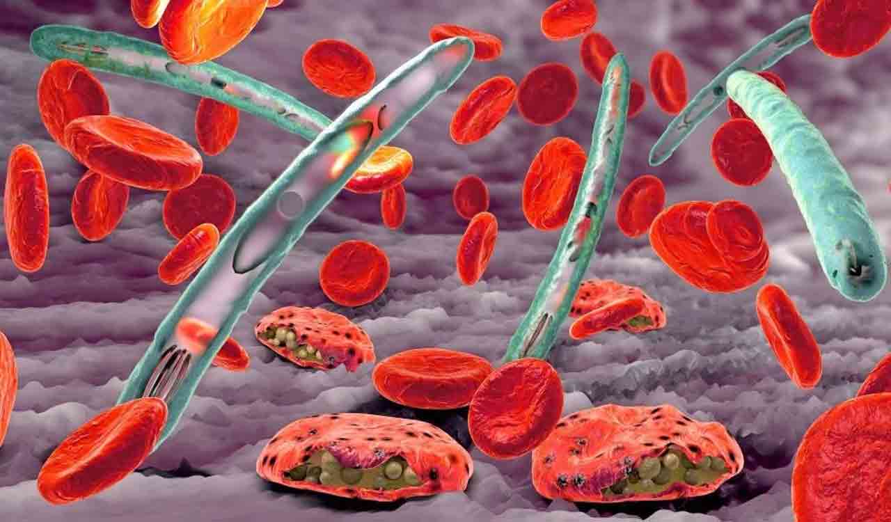 AI-based automated microscope successfully detects malaria in travellers