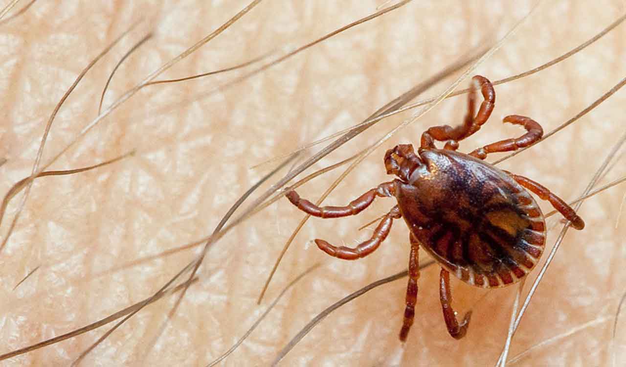 Pakistan: Another person tests positive for Congo fever in Karachi ...