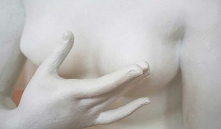 Breast Tumour