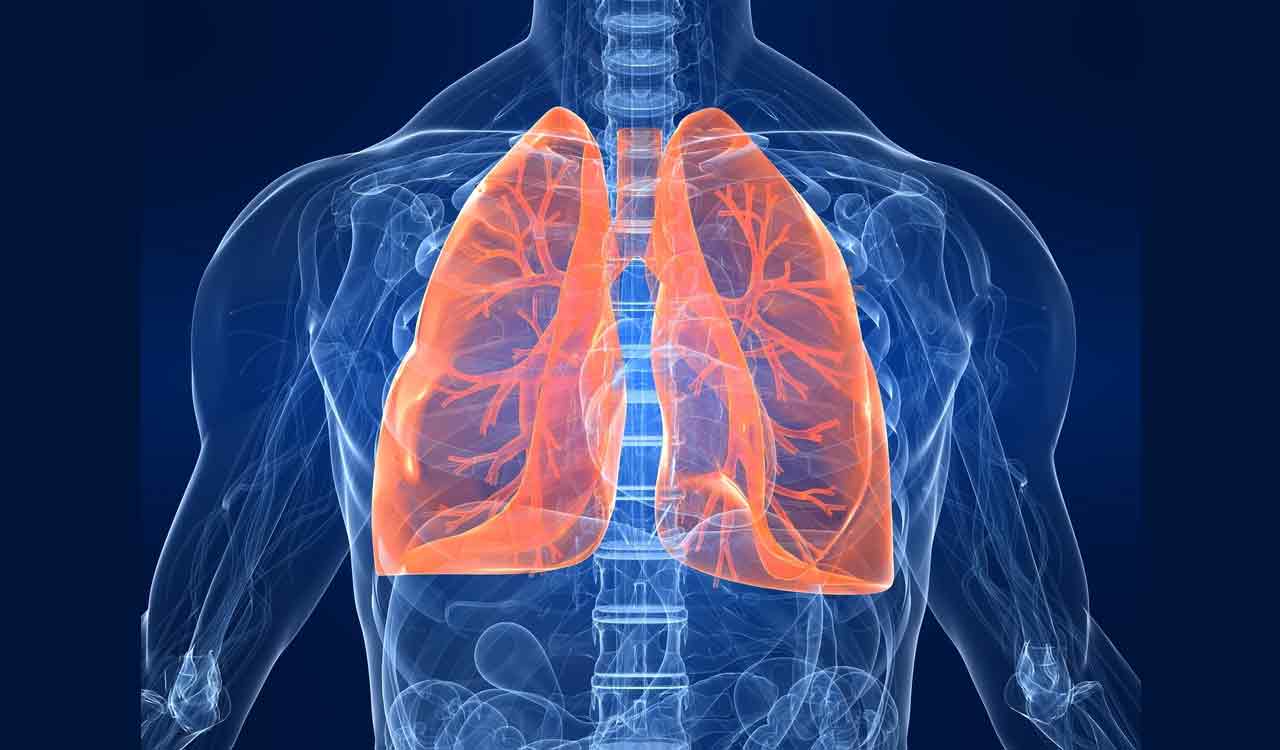 New cell therapy shows promise for Covid-related respiratory distress