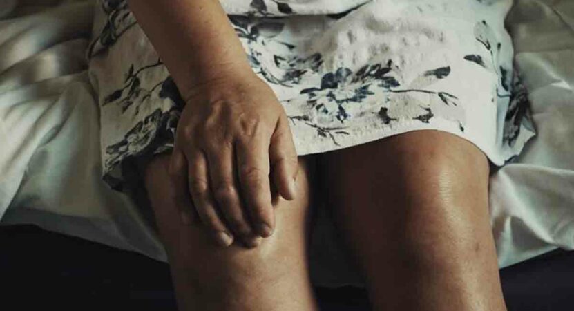 Rheumatoid Athritis