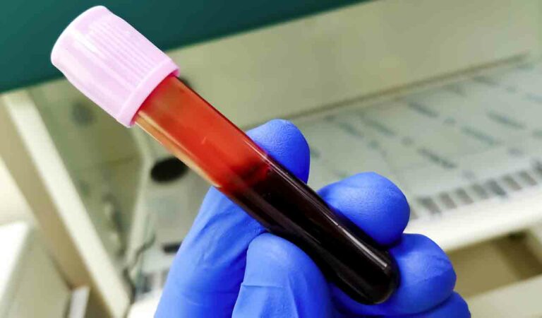 TSDCA advisory on blood plasma