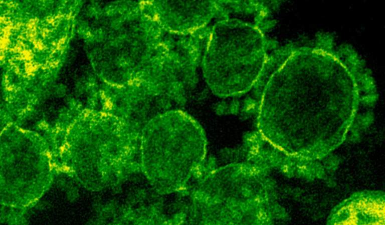 Bacteria