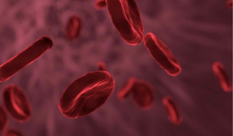 Thalassemia