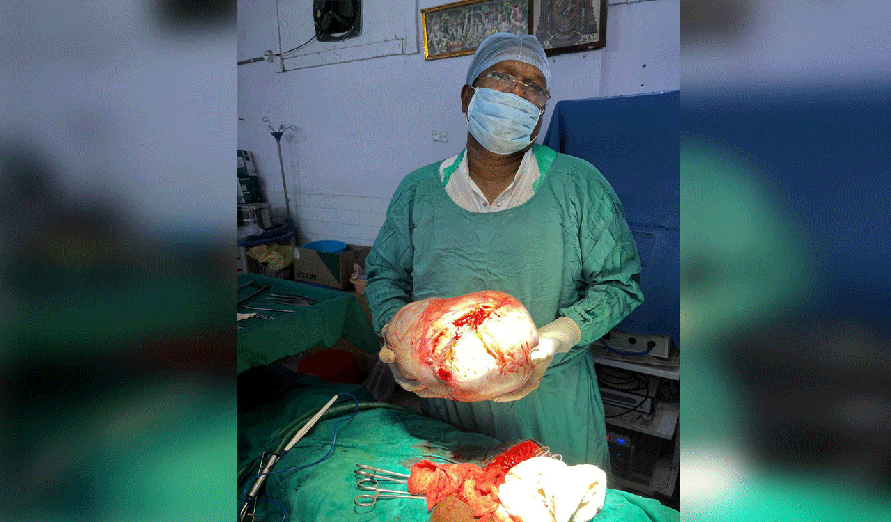 Ramagundam Mayor performs operation, removes 15 kg tumor