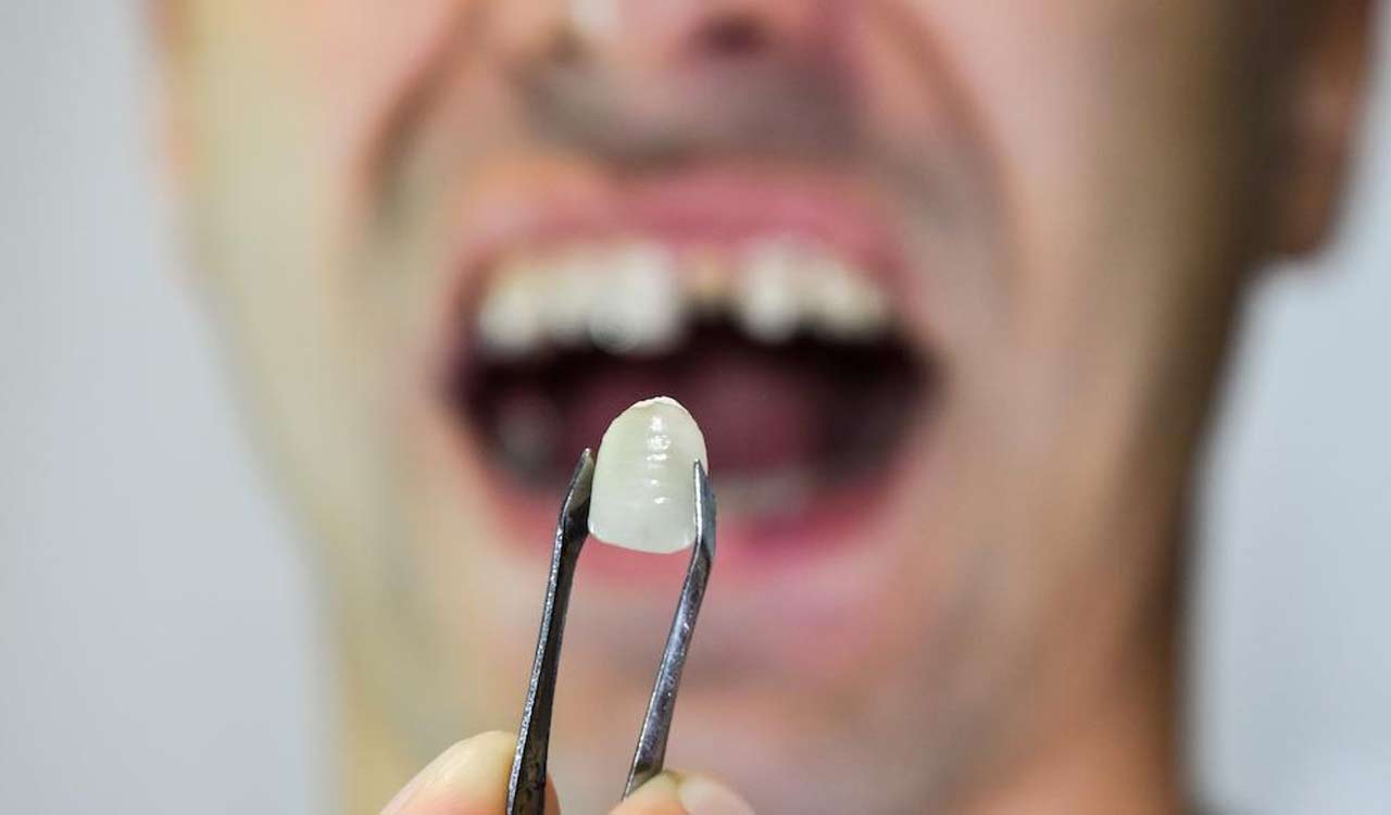 Alcohol mouthwash may harm oral health: Study