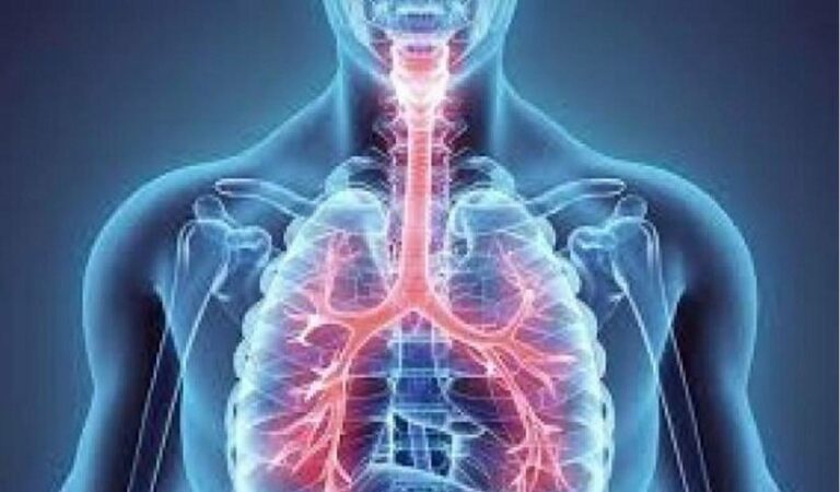 Asthma