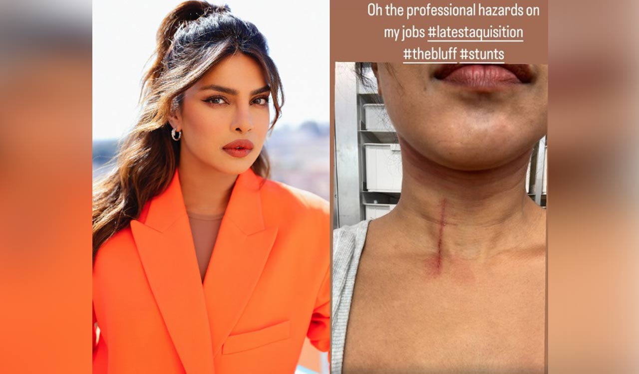 Priyanka Chopra reveals ‘The Bluff’ set injury