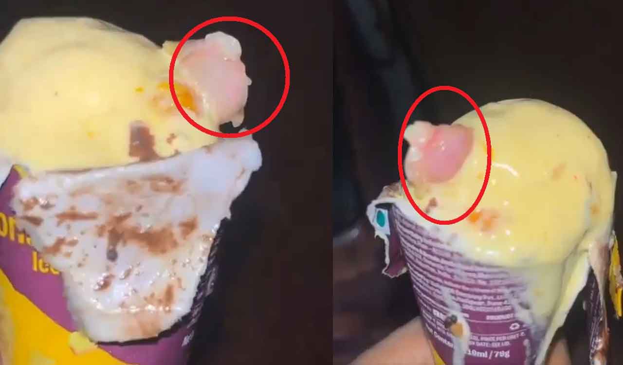 Watch: Doctor finds piece of flesh with nail in butterscotch ice-cream cone
