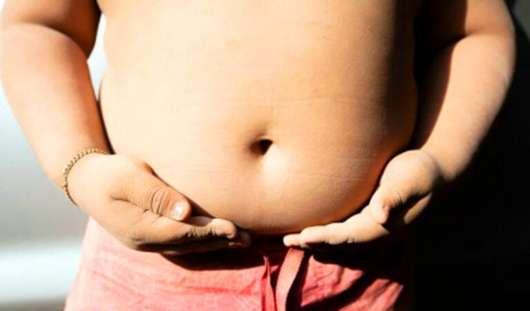 Obese children