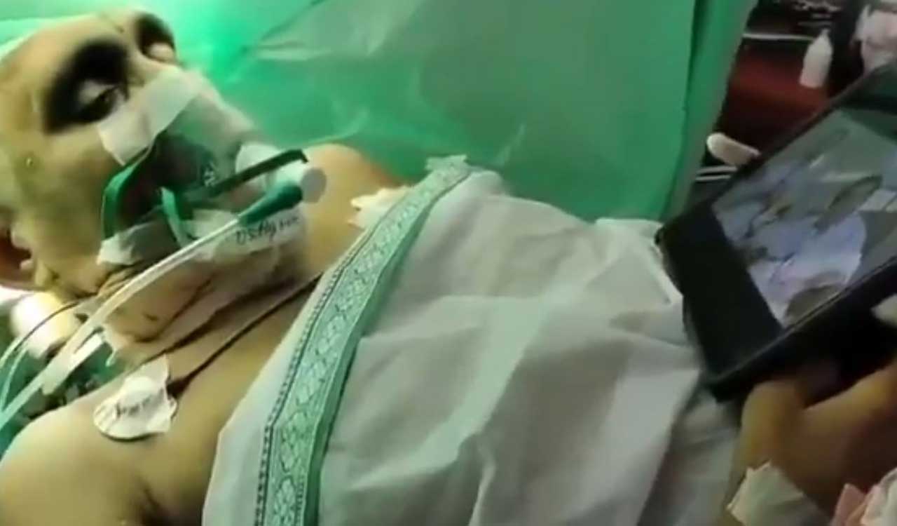 Doctors perform brain surgery as patient watches Jr. NTR’s ‘Adhurs’ film in Kakinada