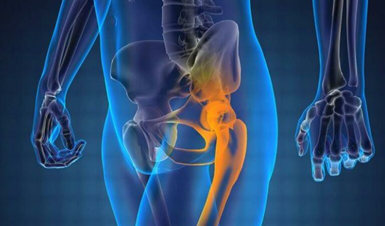 Prostate cancer