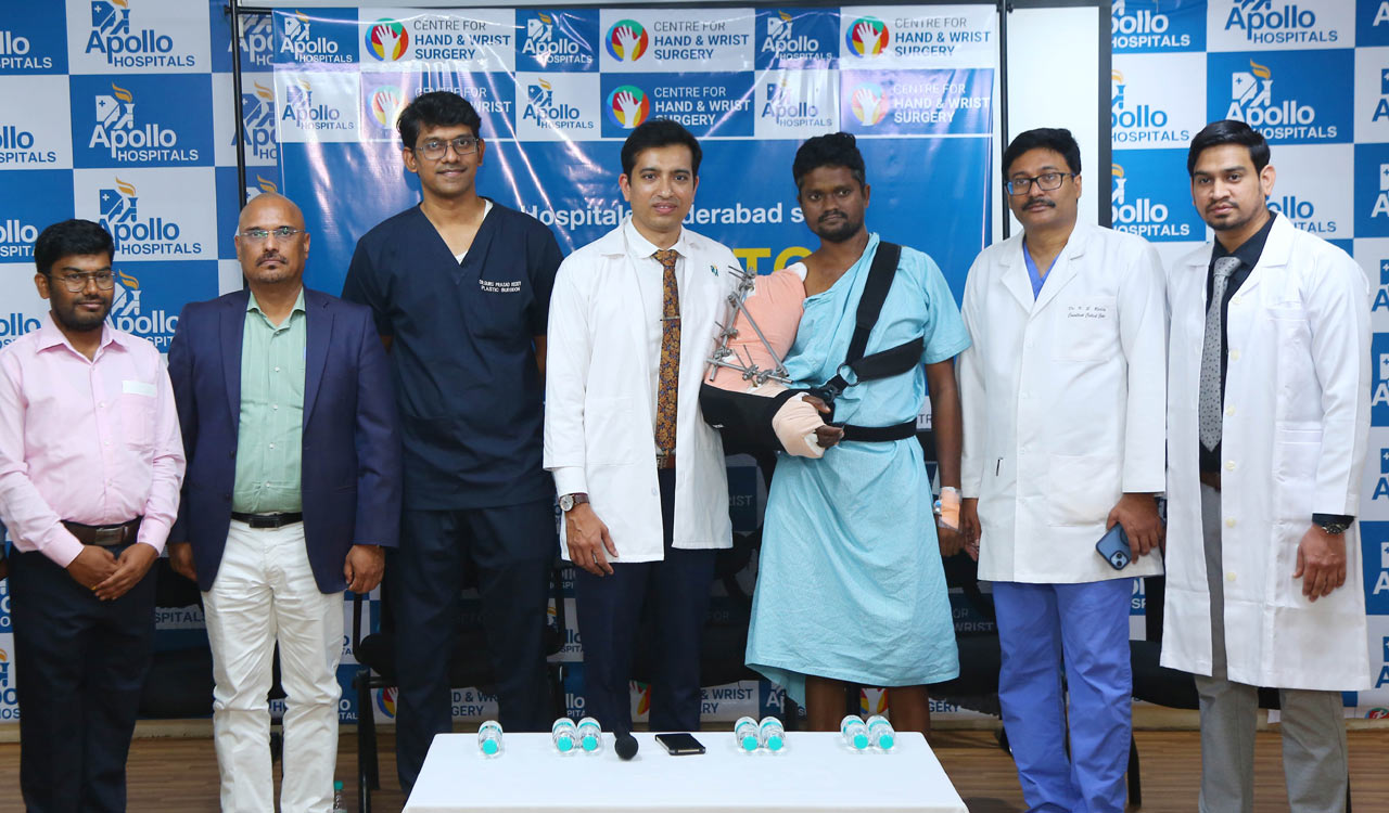 Apollo Hospitals Hyderabad pioneers Microvascular Hand Replantation in Telugu states