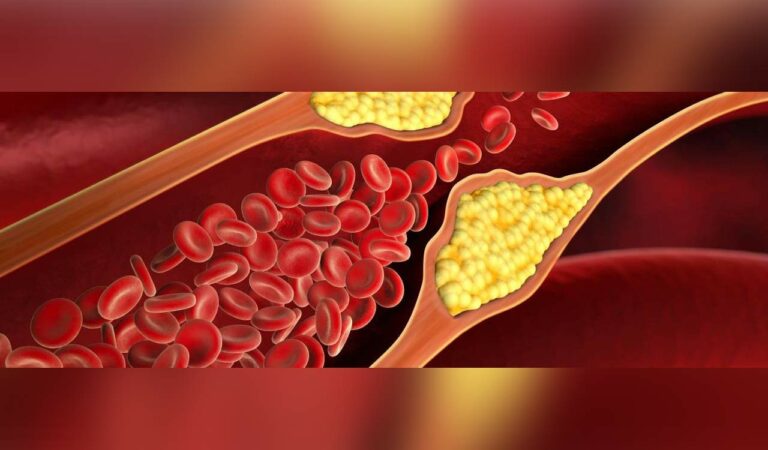 Covid infection