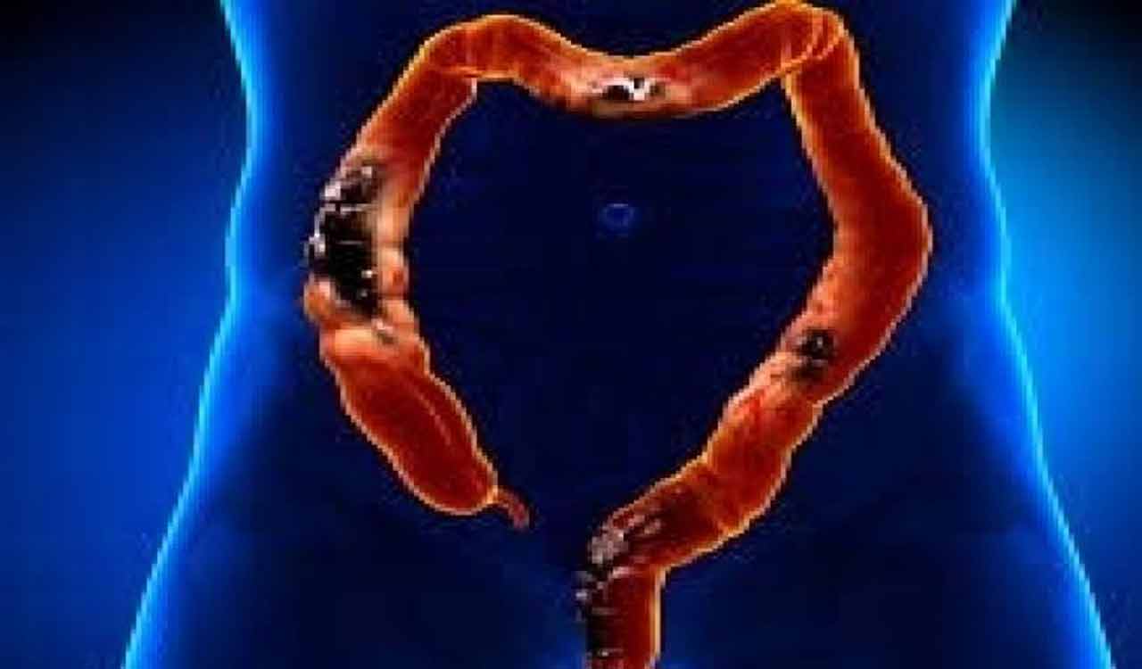 Scientists test grape compound’s potential to prevent bowel cancer