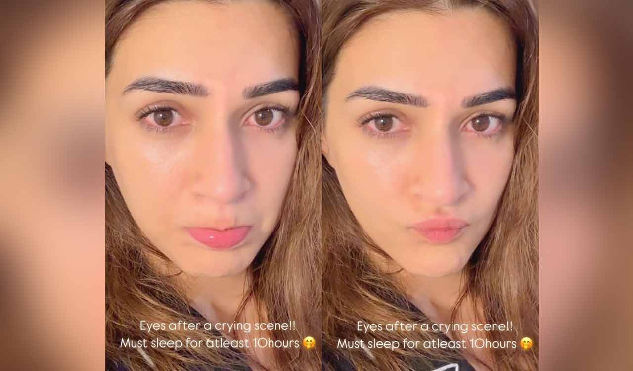 Kriti Sanon shares pictures of eyes post crying scene, needs 10 hours of sleep