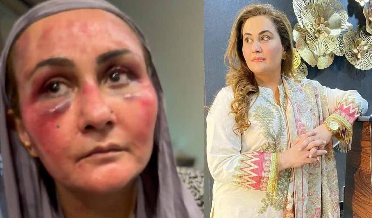 Hit with gun and dragged by hair, Pakistani actress reveals brutal torture