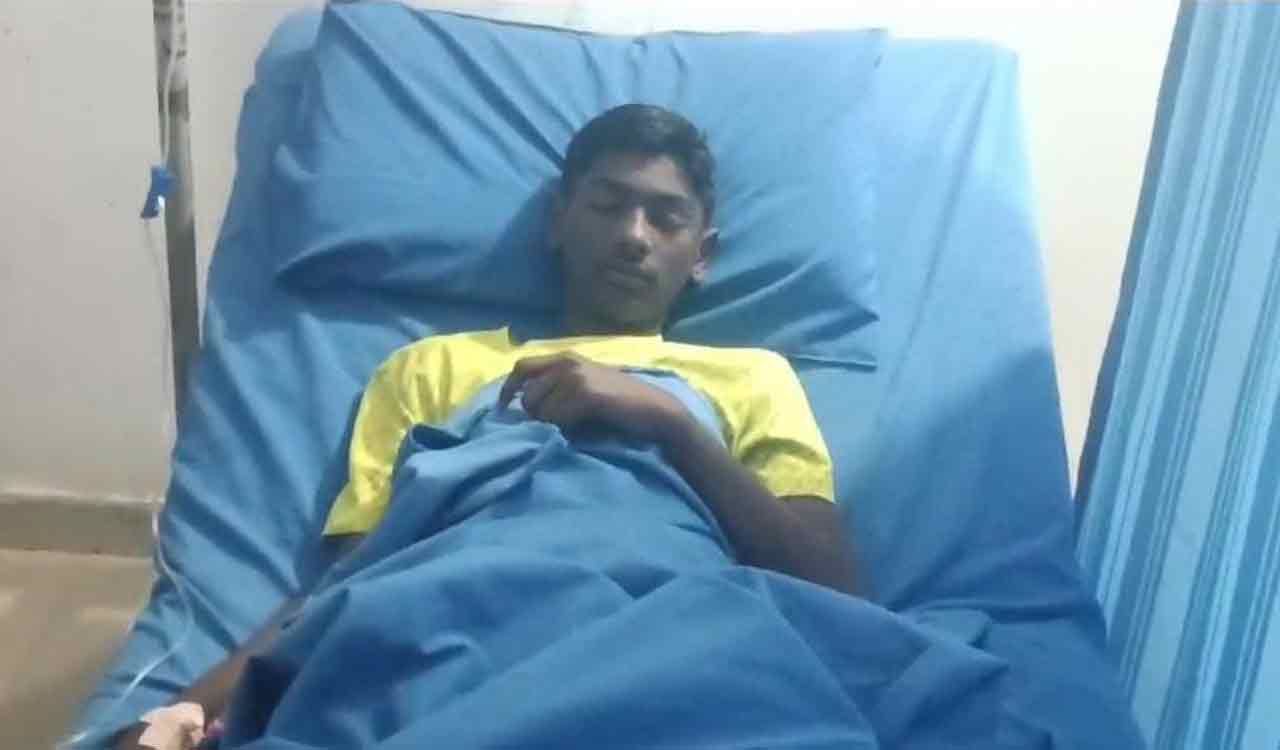 Student suffers burns: Survel residential school principal suspended