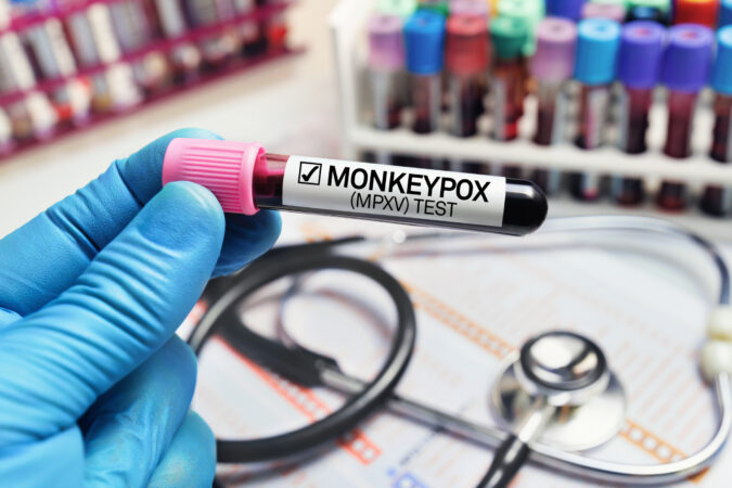mpox