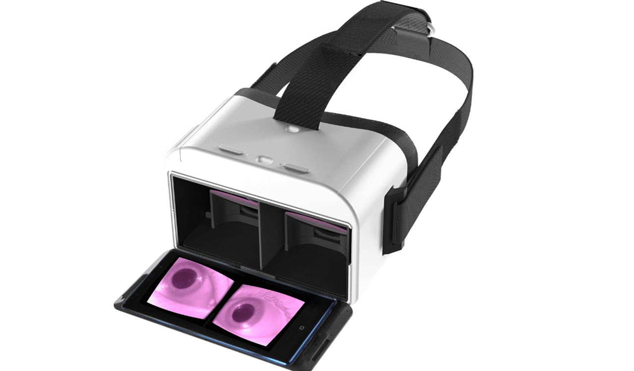 VR headset to detect defects in the eye