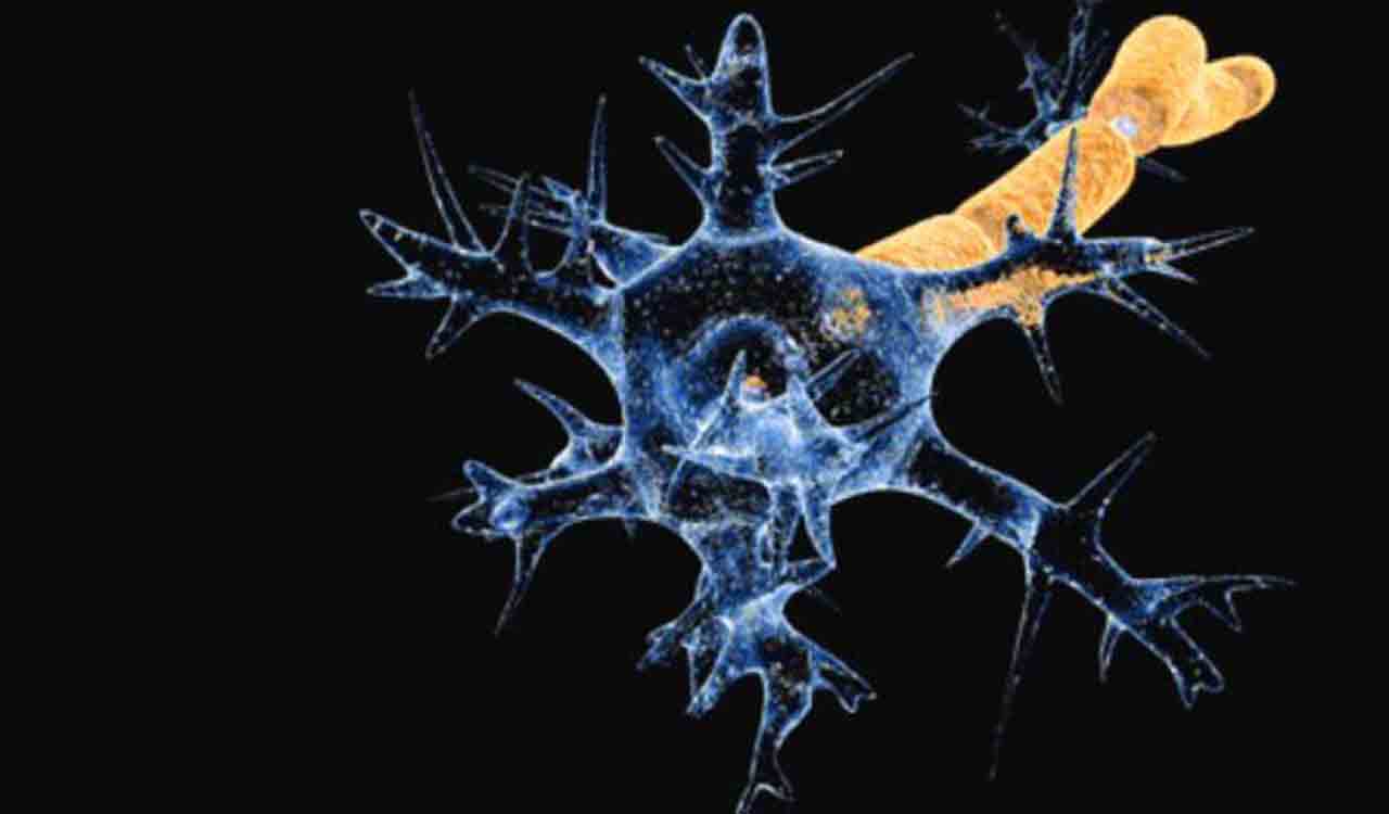 Three die of suspected Guillain-Barre Syndrome in West Bengal