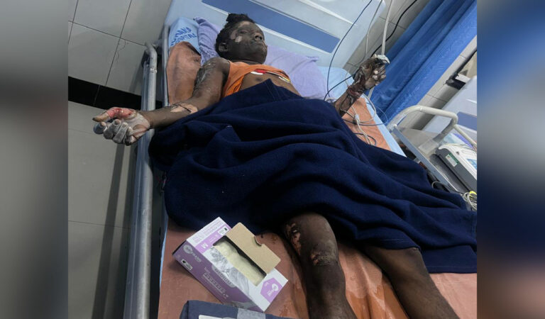 Seven injured in reactor blast at IDA Bollaram