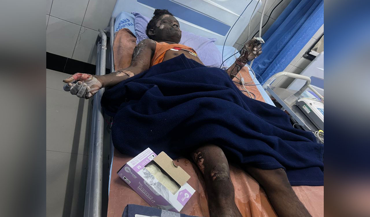 Seven injured in reactor blast at IDA Bollaram in Hyderabad