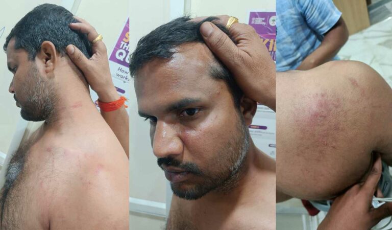 Telangana: BRS leader assaulted by Congress workers