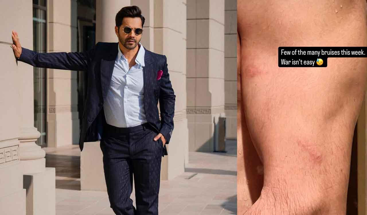 Varun Dhawan filming ‘Border 2’ showcases ‘few of the many bruises’ he sustained