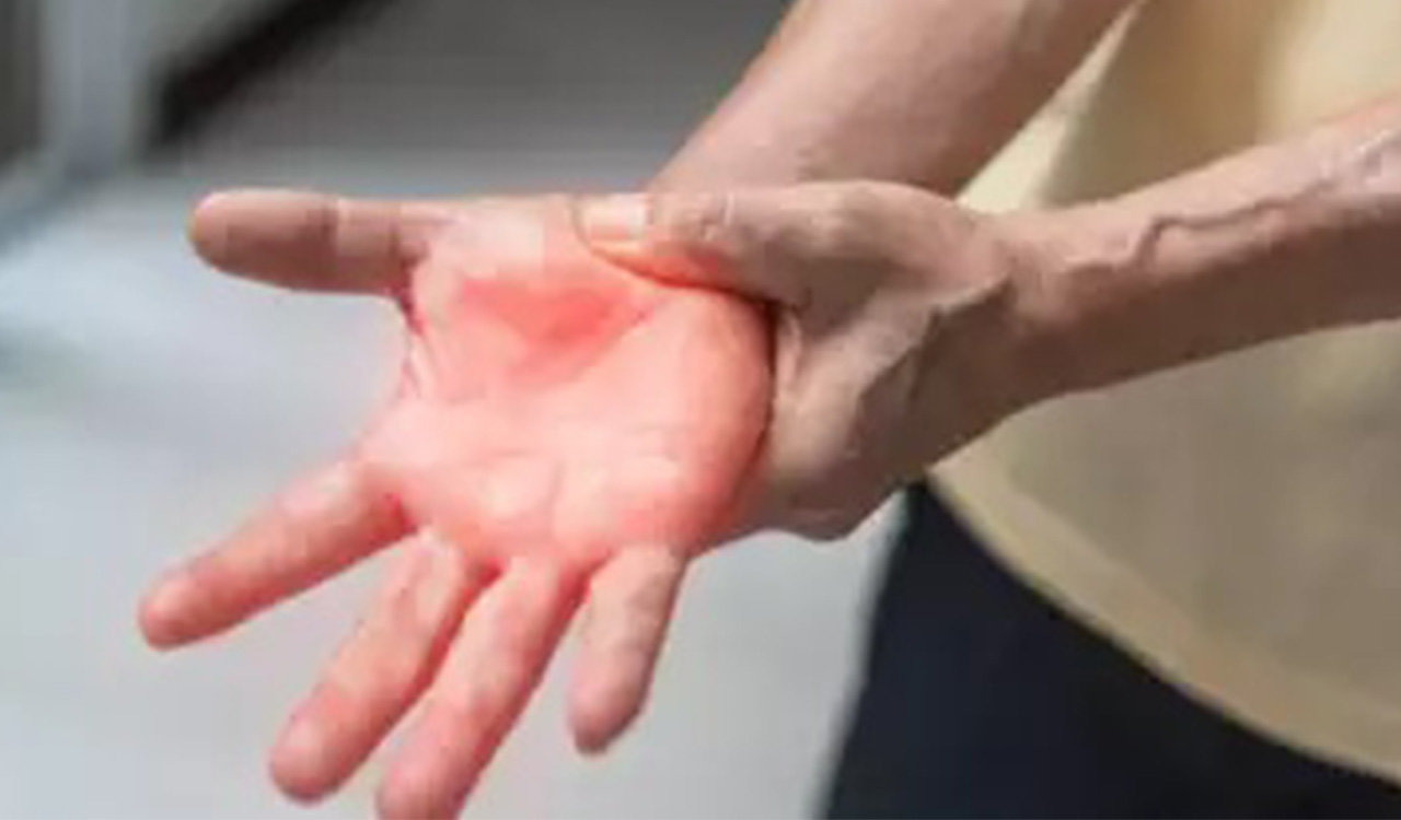 Guillain-Barre Syndrome cases rise to 163 in Maharashtra