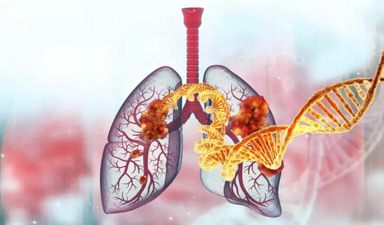 Cases of lung cancer in non-smokers increase, air pollution could be reason: Lancet study