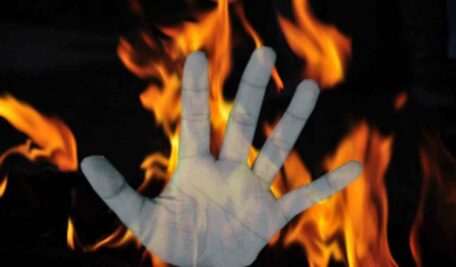 Jilted lover sets married woman afire after she refuses to elope with him