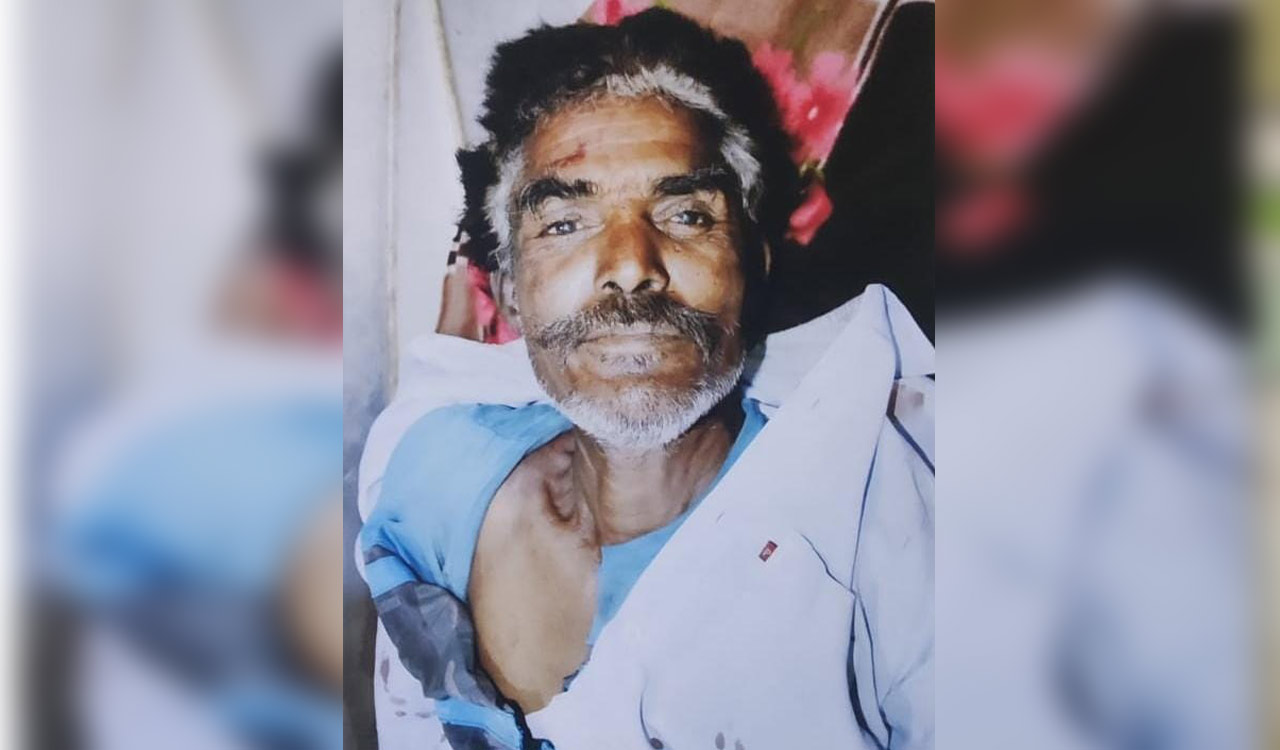 Ironic Death! Snake catcher dies of snakebite in Telangana’s Medak district