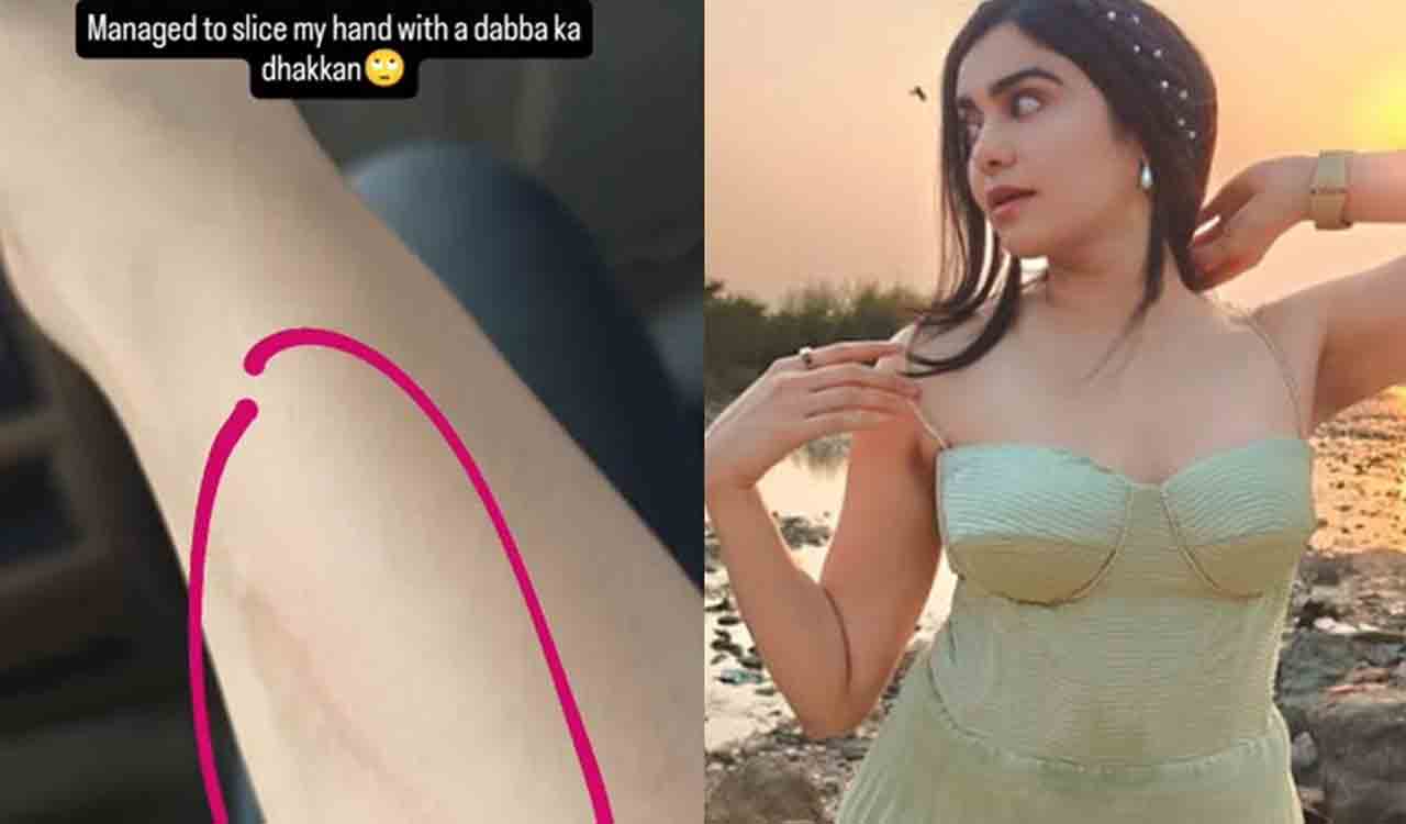 Adah Sharma’s quirky moment: ‘Cuts’ her hand with ‘dabba ka dhakkan’