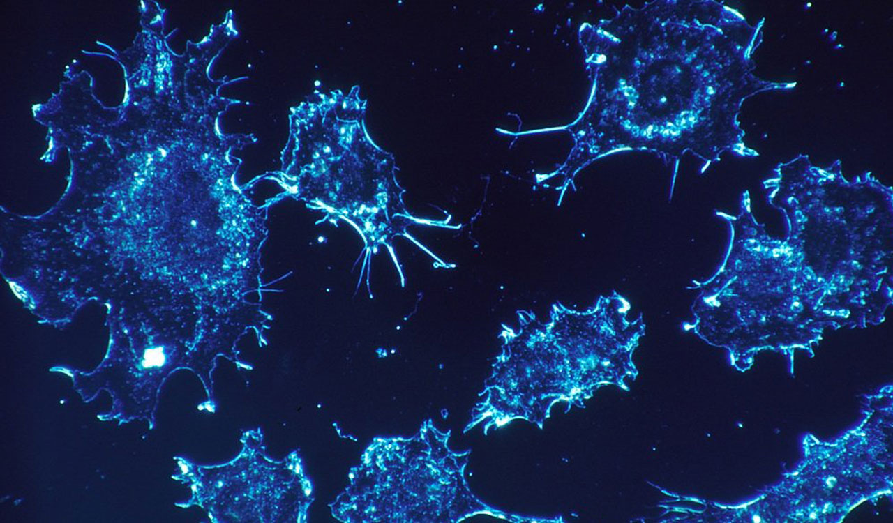 Scientists develop method to expose cancer cells to immune system