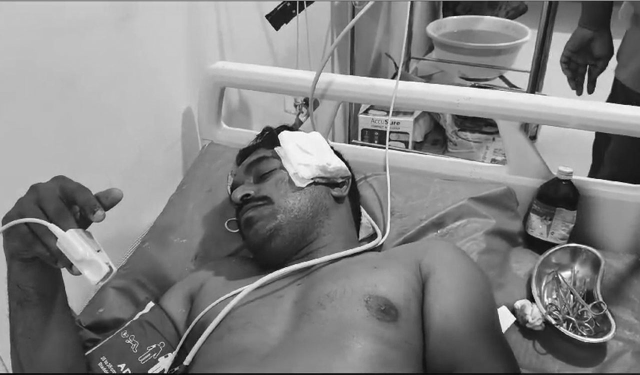 Constable stabbed multiple times while trying to nab thief in Khammam’s Sathupalli