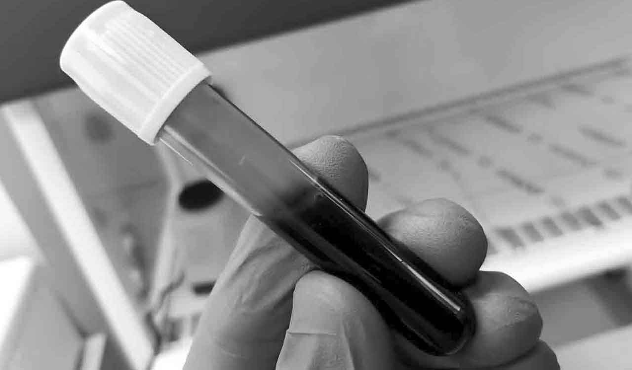 No more needles, as AI-tech based solutions deliver instant blood test results in minutes