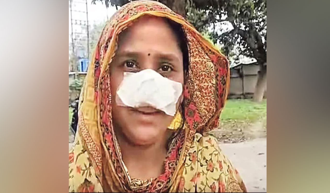 Husband bites off wife’s nose in shocking attack