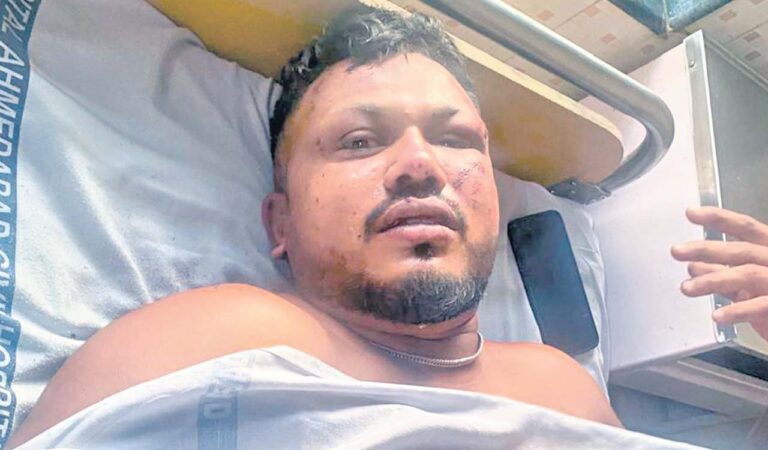 Rewind: Dreamliner’s sole survivor brings back memories of lone survivors — From Amazon to Ahmedabad