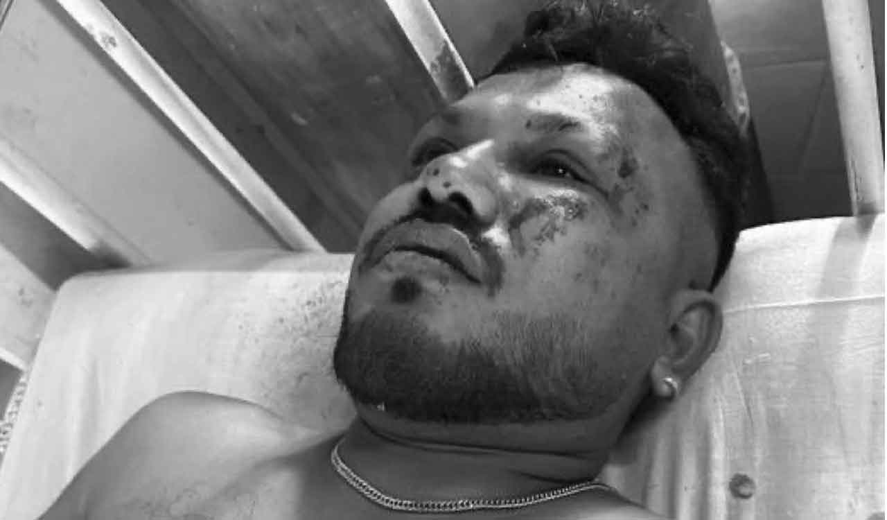 Air India AI 171 crash: 40-year-old survivor recounts horror after deadly Ahmedabad disaster