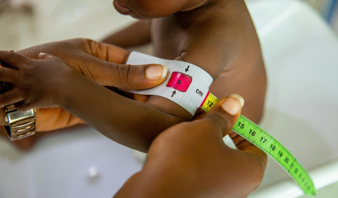 Alarming data: 33 percent of children in Telangana suffer from stunted growth due to malnutrition