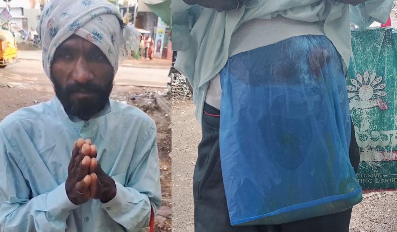 Man with surgical pouch seeks help in Hyderabad