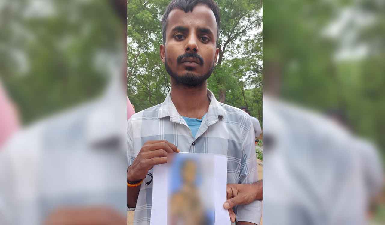 Sangareddy: Burn survivor still awaits compensation 2 years after industrial fire