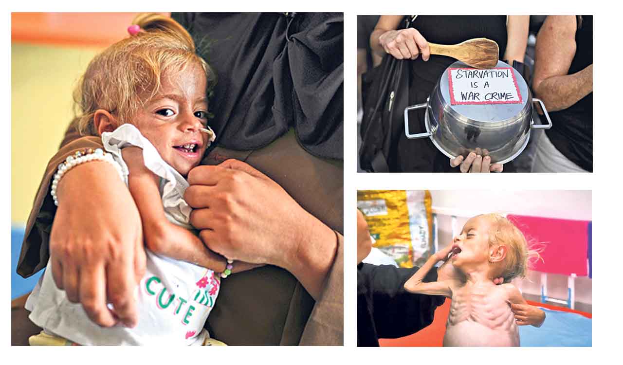 Opinion: Gaza conflict—Starvation as a weapon of war