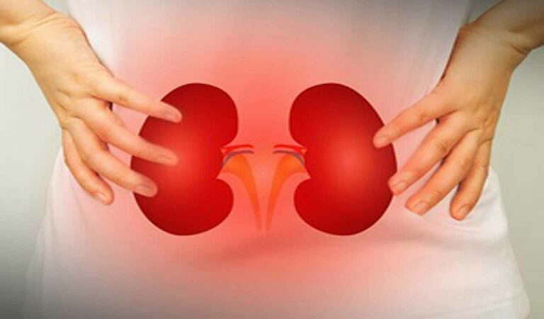 Kidney Disease