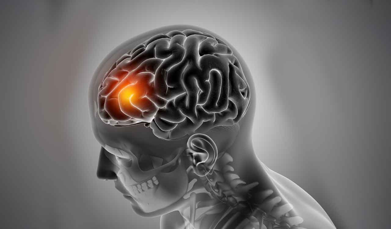 Indian MBBS student airlifted from Kazakhstan to Jaipur after brain stroke