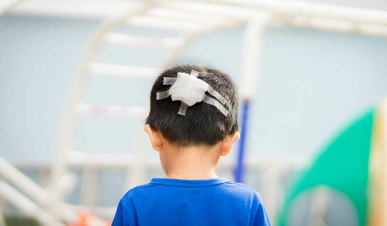 Two children injured as ceiling slab collapses in Thane building